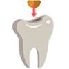 Dental Filling in Majura