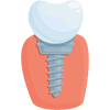 Dental Implants in Ena