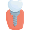 Dental Implants in Piplod