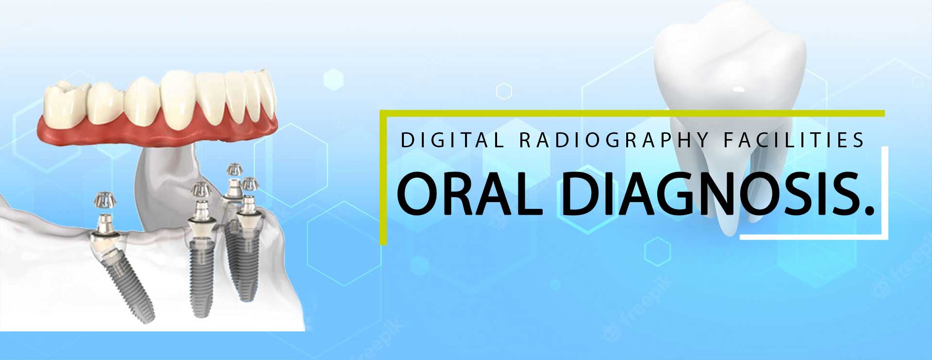 Oral Diagnosis in Hirabaugh