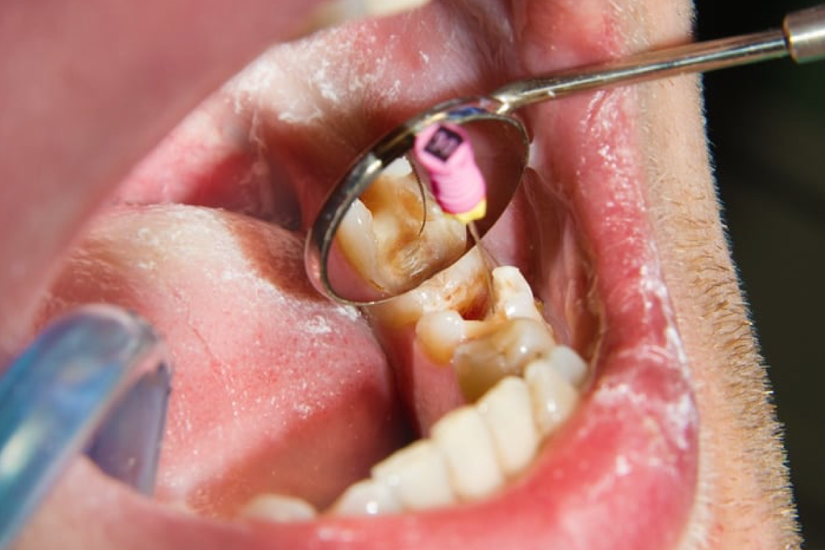 General Dentistry Treatments You Need To Know About