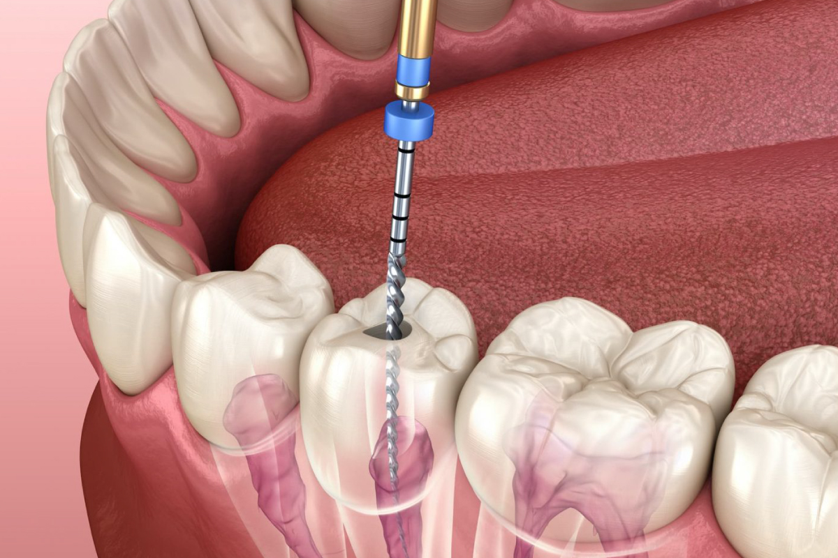 How Dental Clinics Help In Personality Development