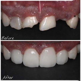 Cosmetic Dentist in Ena