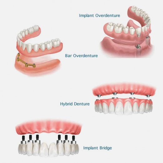 Denture Specialist in Parvat Patiya