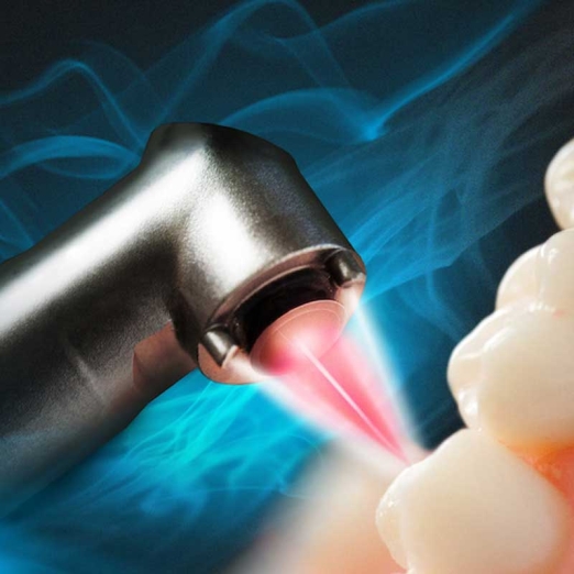 Laser Dentistry in Bamroli