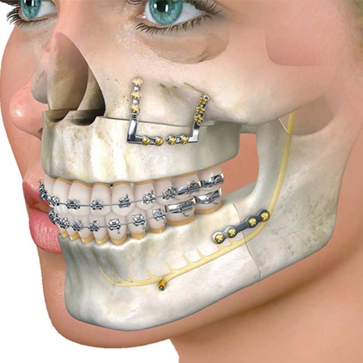 Maxillofacial Surgery in Bilimora