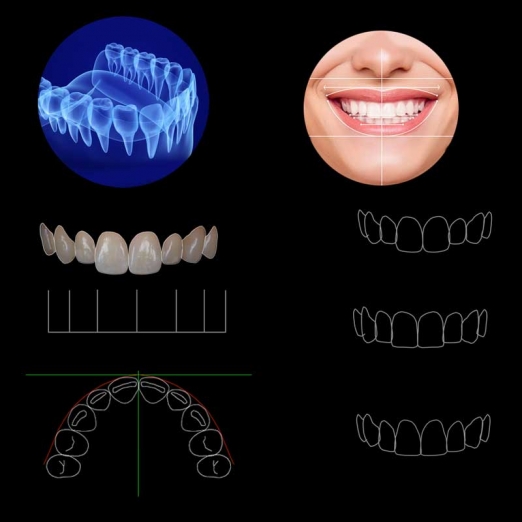 Smile Design Dentist in Uttran