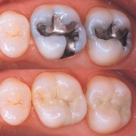 Dental Care Treatments in Ena